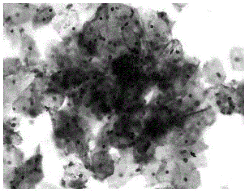 Endocervical cell preserving fluid and method for preparing endocervical cell specimen