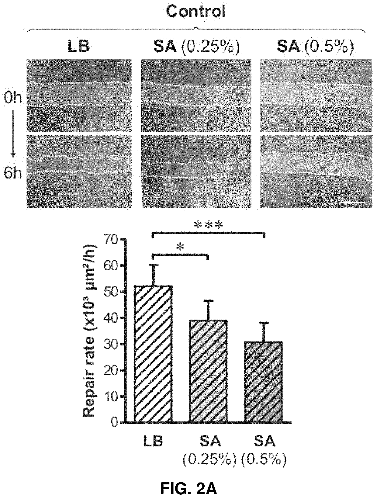 Use of rock inhibitors for promoting sinonasal epithelial cell repair