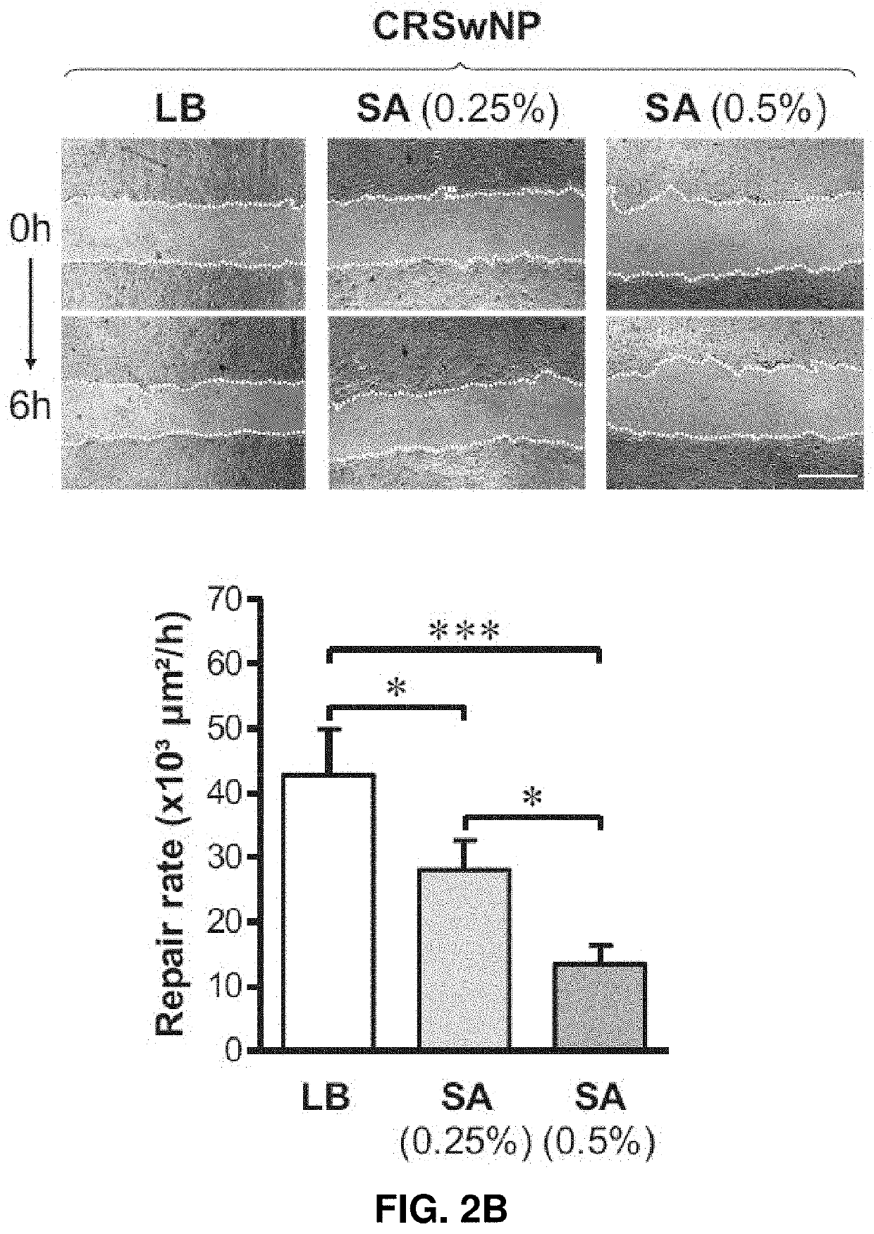 Use of rock inhibitors for promoting sinonasal epithelial cell repair