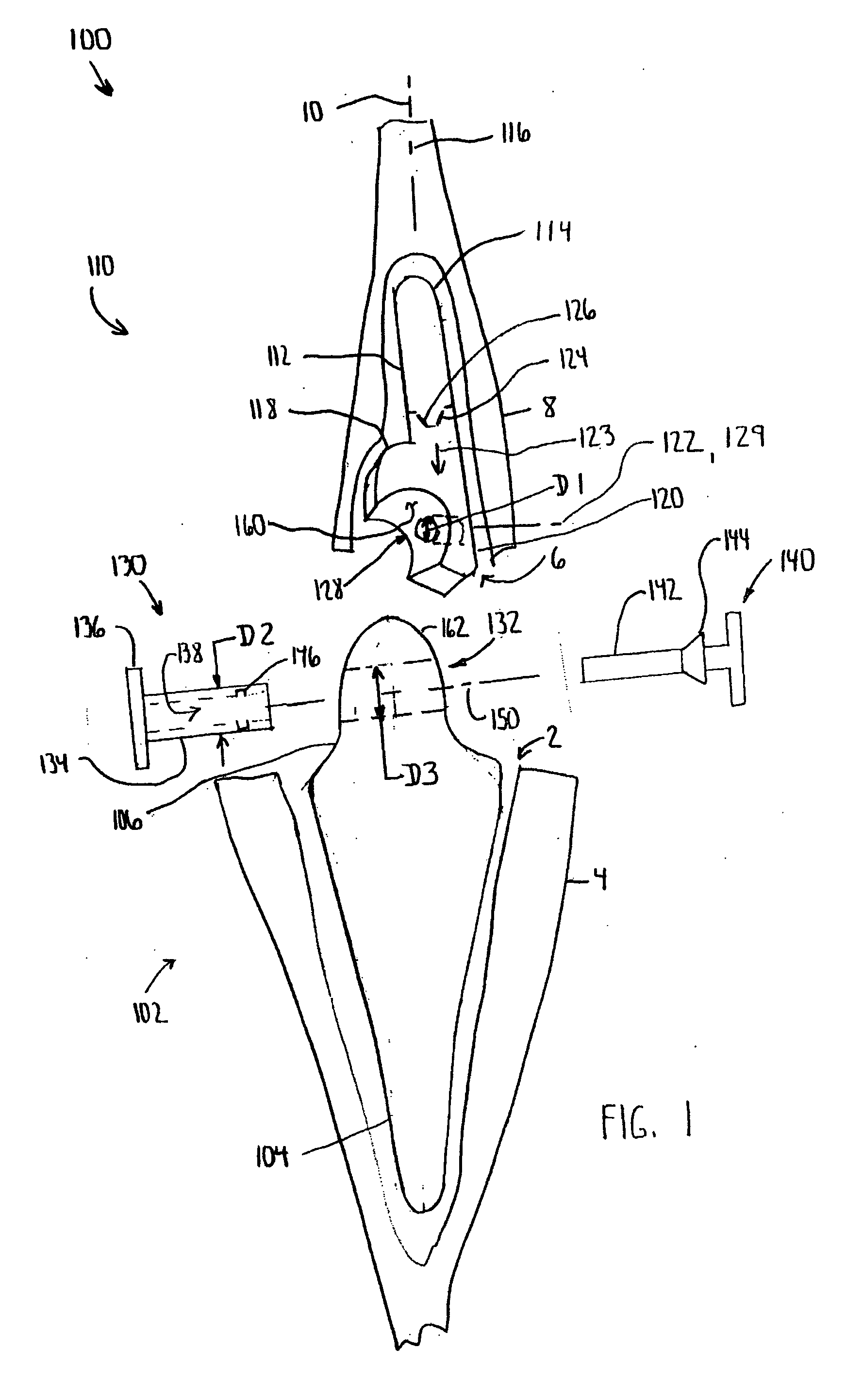 Modular total elbow prosthesis, humeral component and associated kit