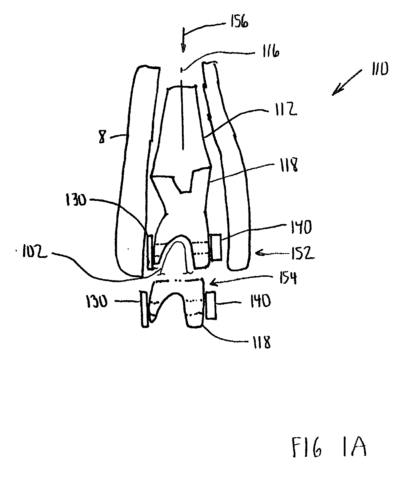 Modular total elbow prosthesis, humeral component and associated kit