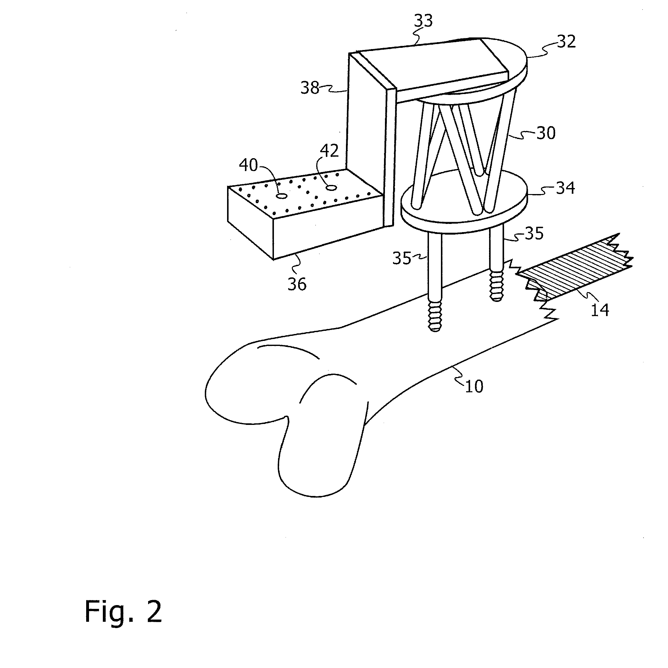 Robot for use with orthopaedic inserts