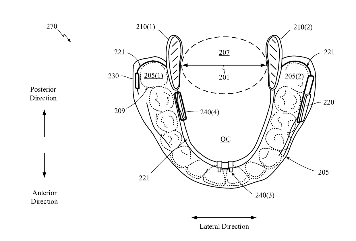 Predicting an onset of apnea