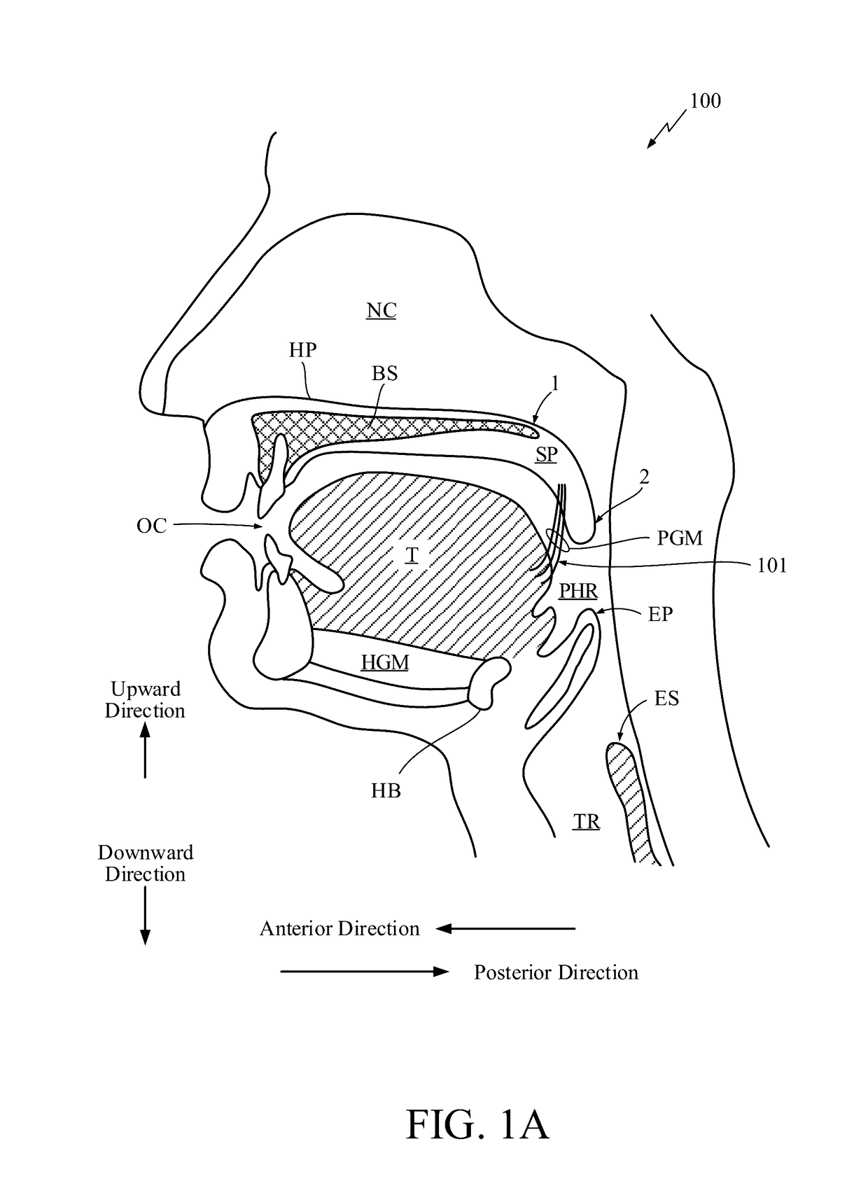 Predicting an onset of apnea