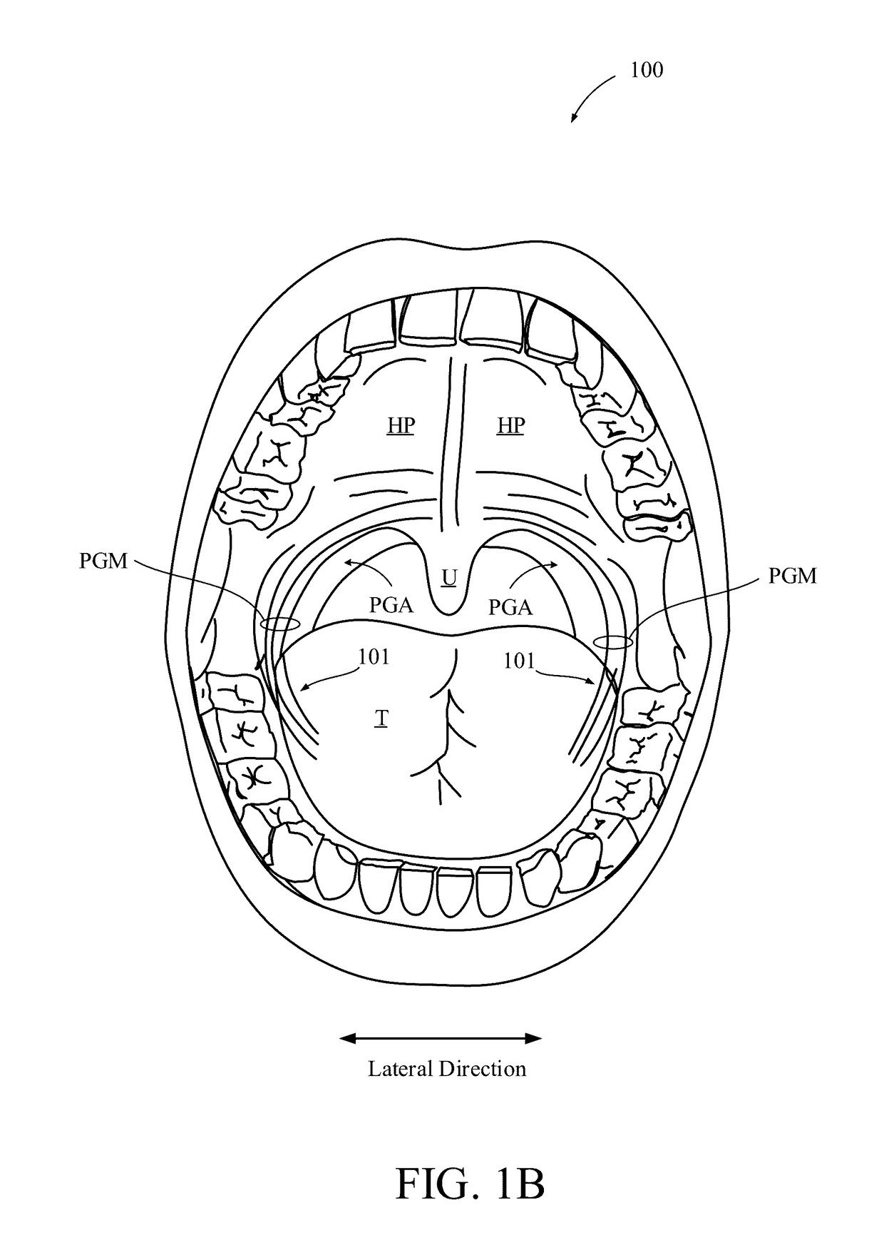 Predicting an onset of apnea