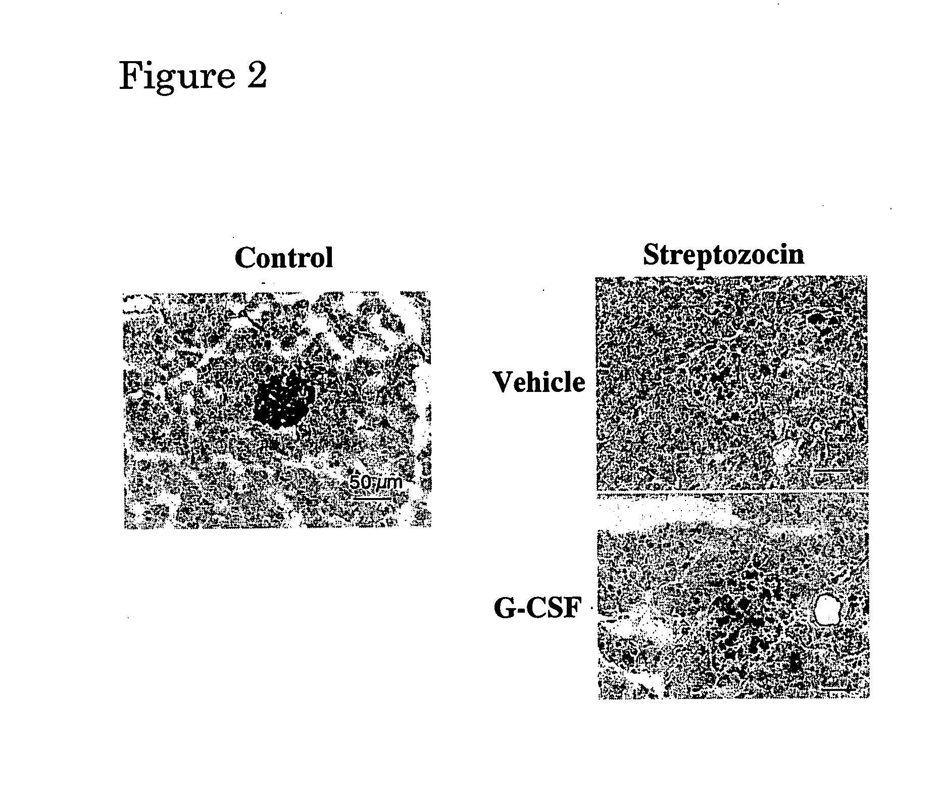 Agent for treating diabetes mellitus