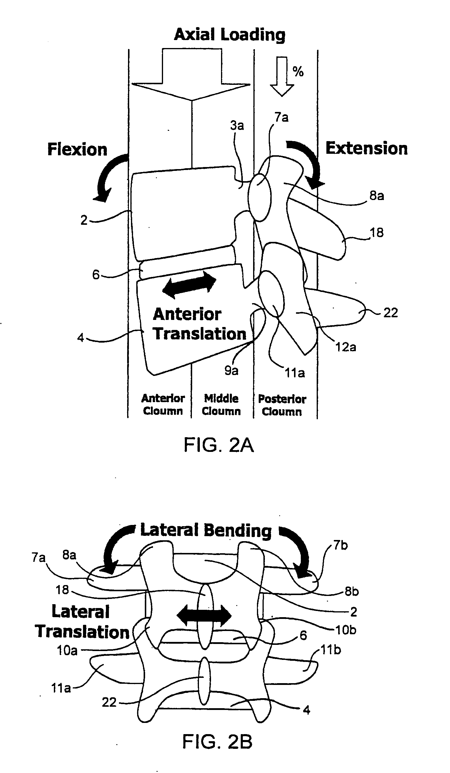 Systems and methods for posterior dynamic stabilization of the spine