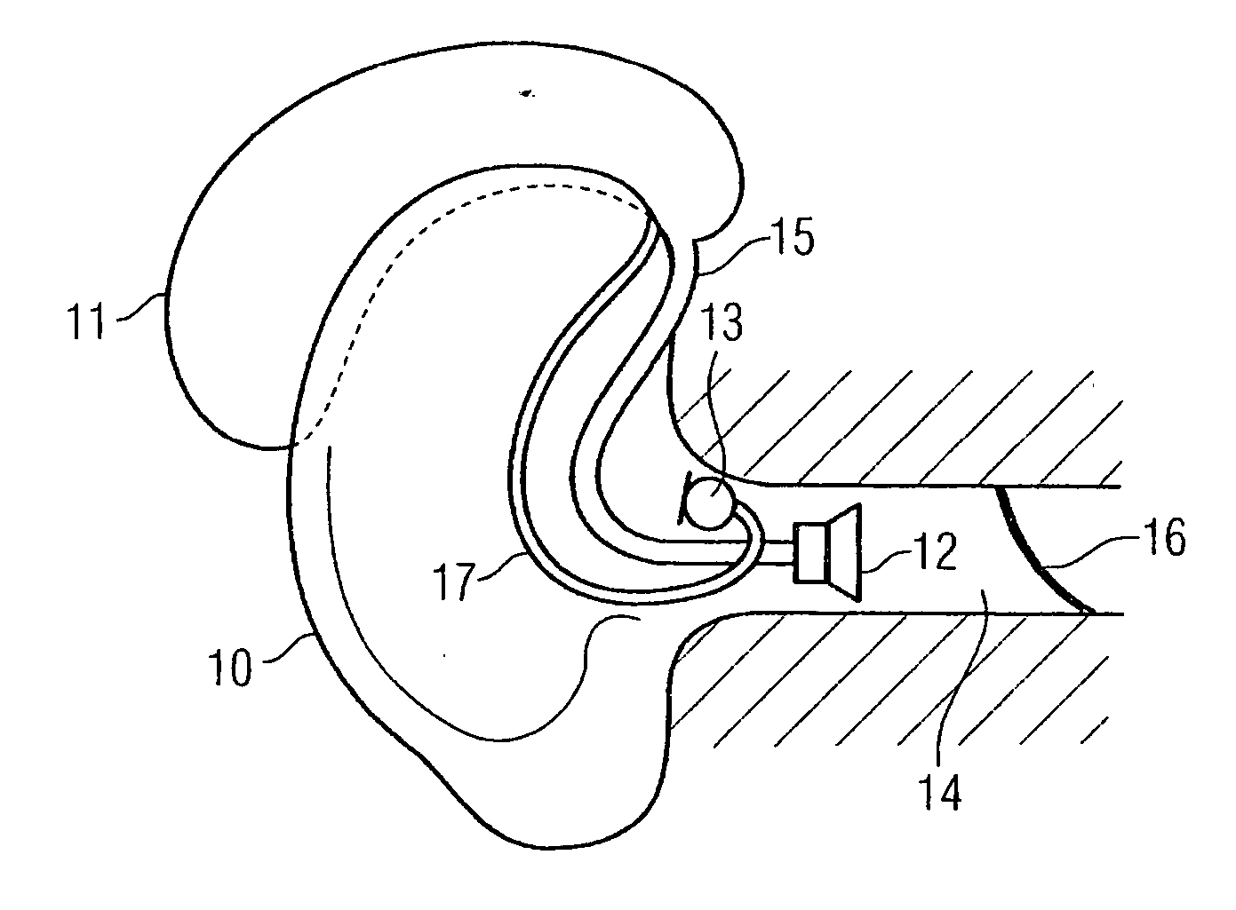 Behind-the-ear hearing device having an external, optical microphone