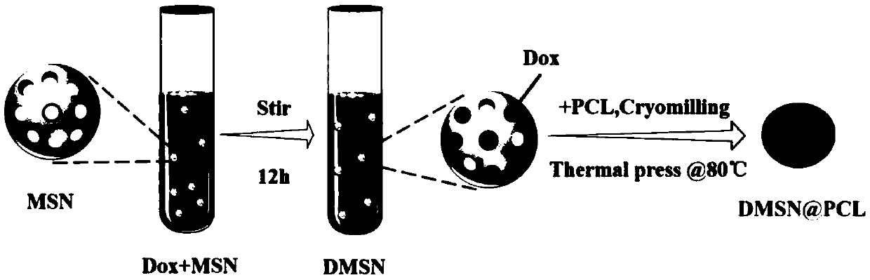 Preparation method and application of nanocomposite material for inhibiting postoperative tumor recurrence