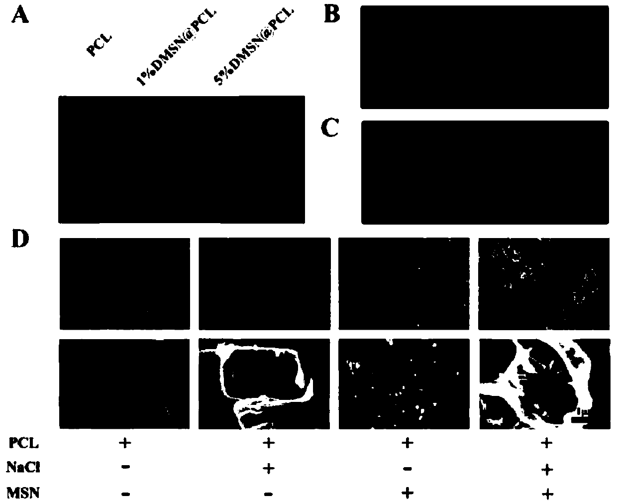 Preparation method and application of nanocomposite material for inhibiting postoperative tumor recurrence