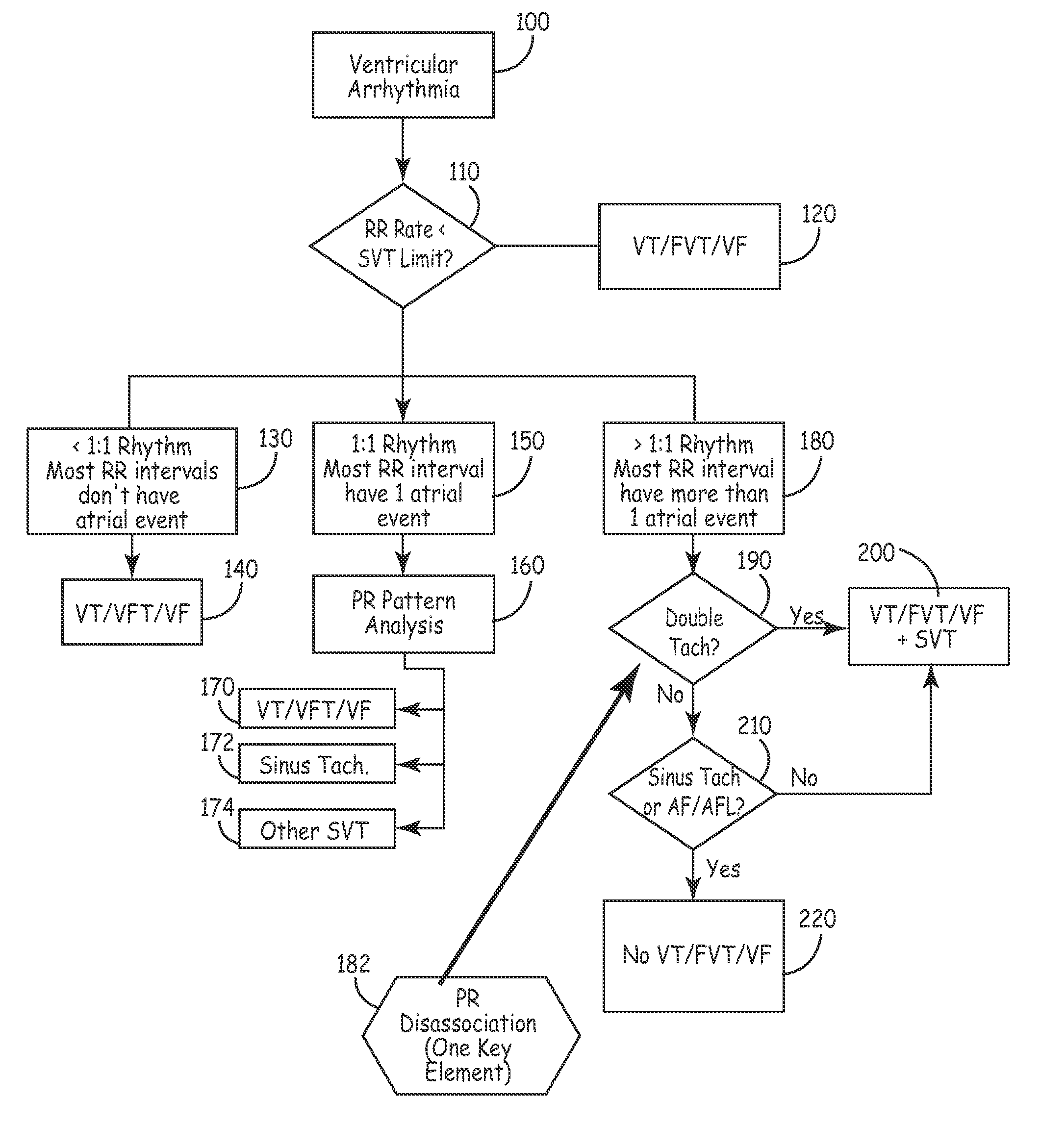 System and method for arrhythmia discrimination with atrial-ventricular dissociation