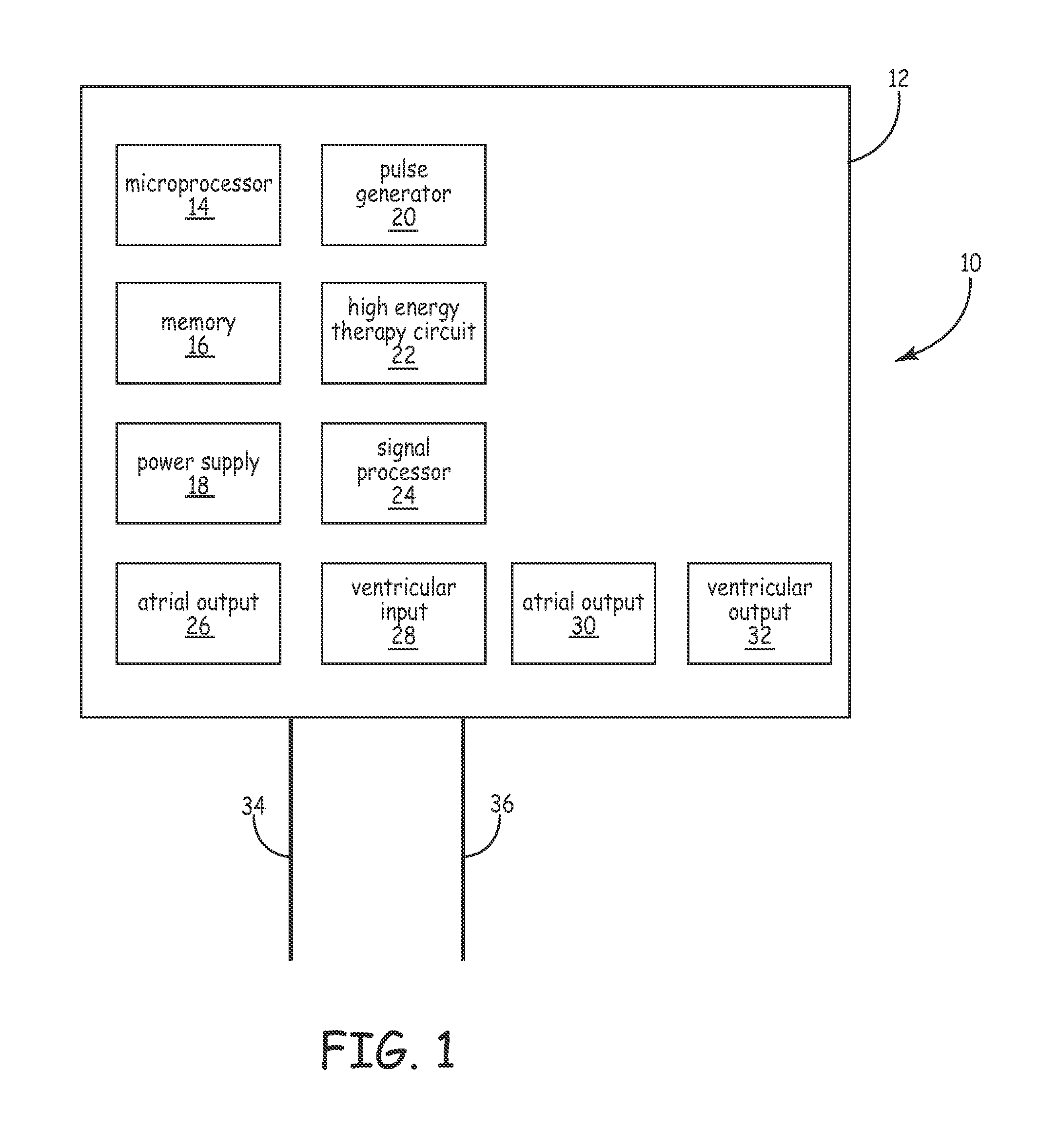 System and method for arrhythmia discrimination with atrial-ventricular dissociation