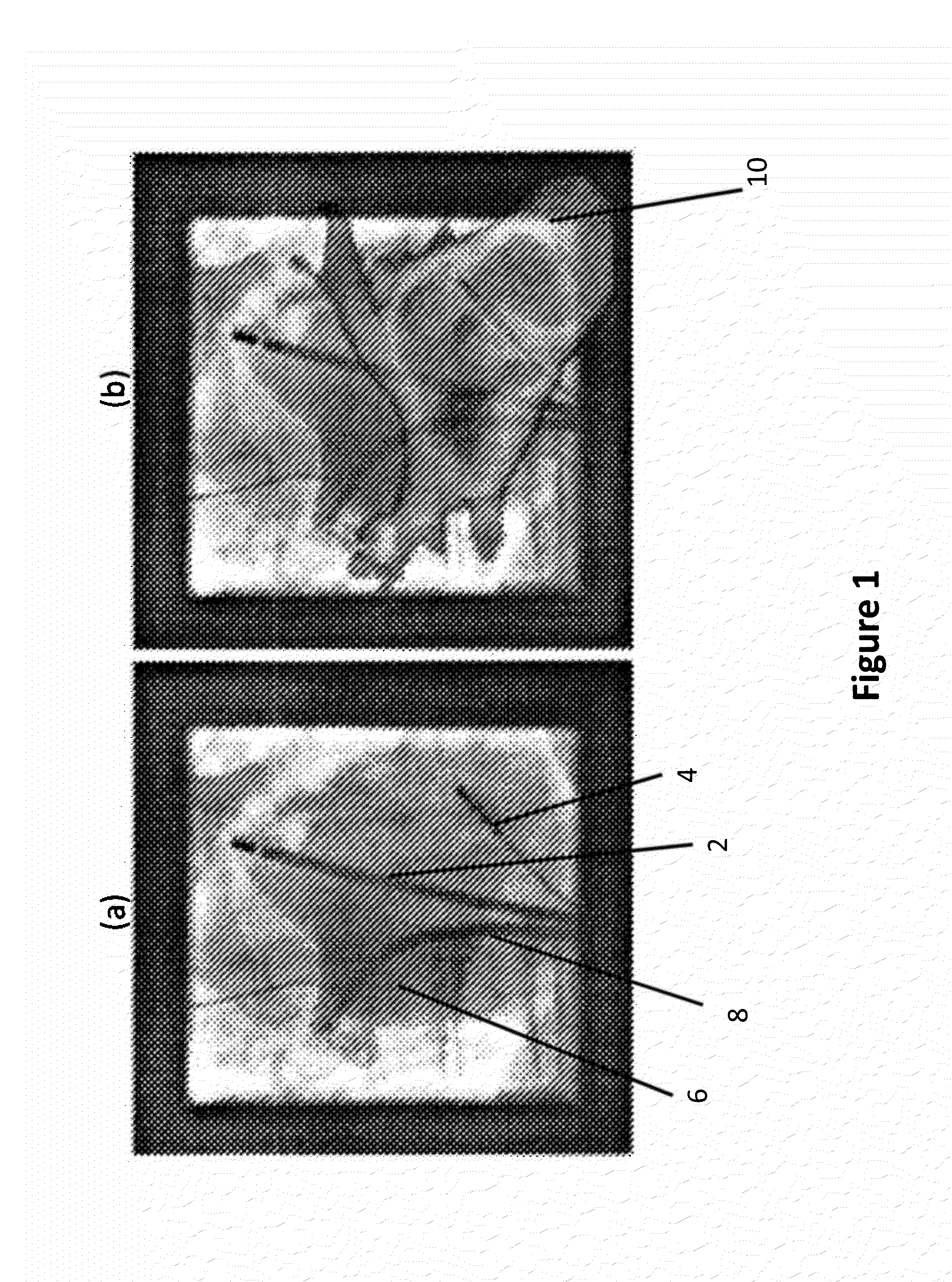 2D/3D image registration method