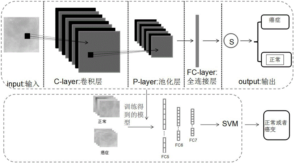 Mammary gland molybdenum target image automatic classification method based on deep learning