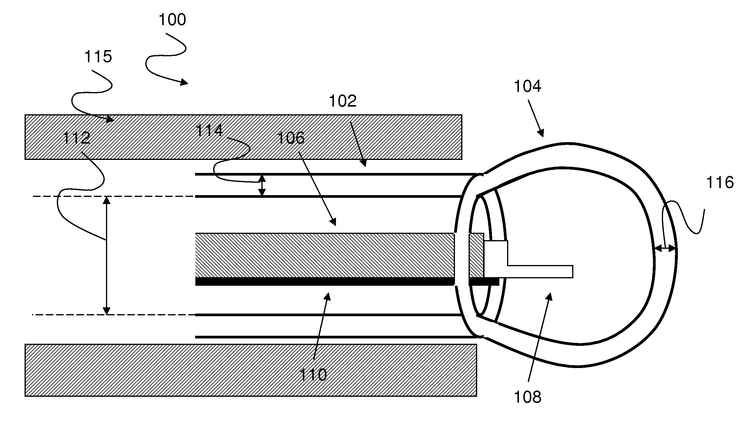 Method and system for intrabody imaging