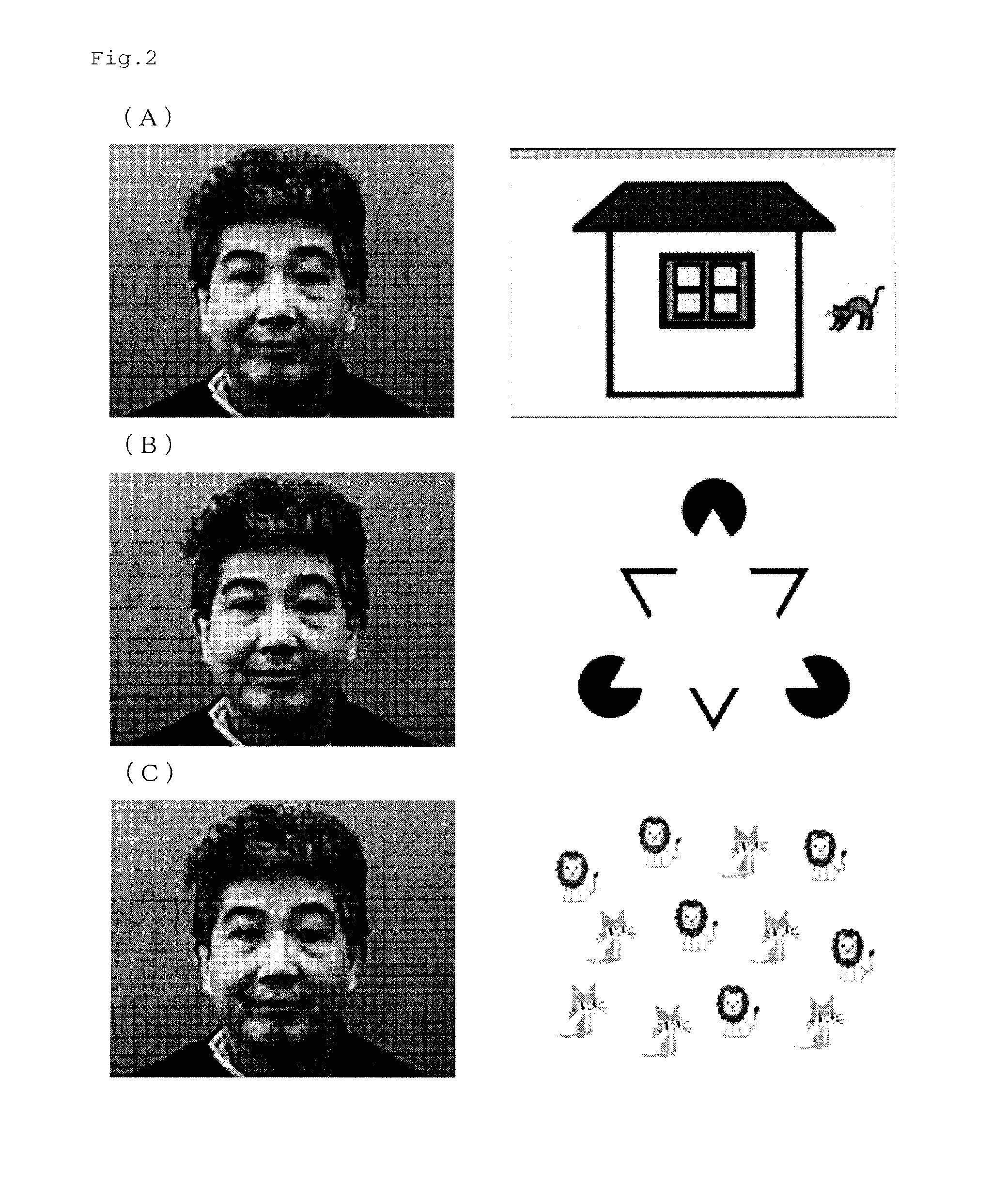 Autism diagnosis support method and system, and autism diagnosis support device