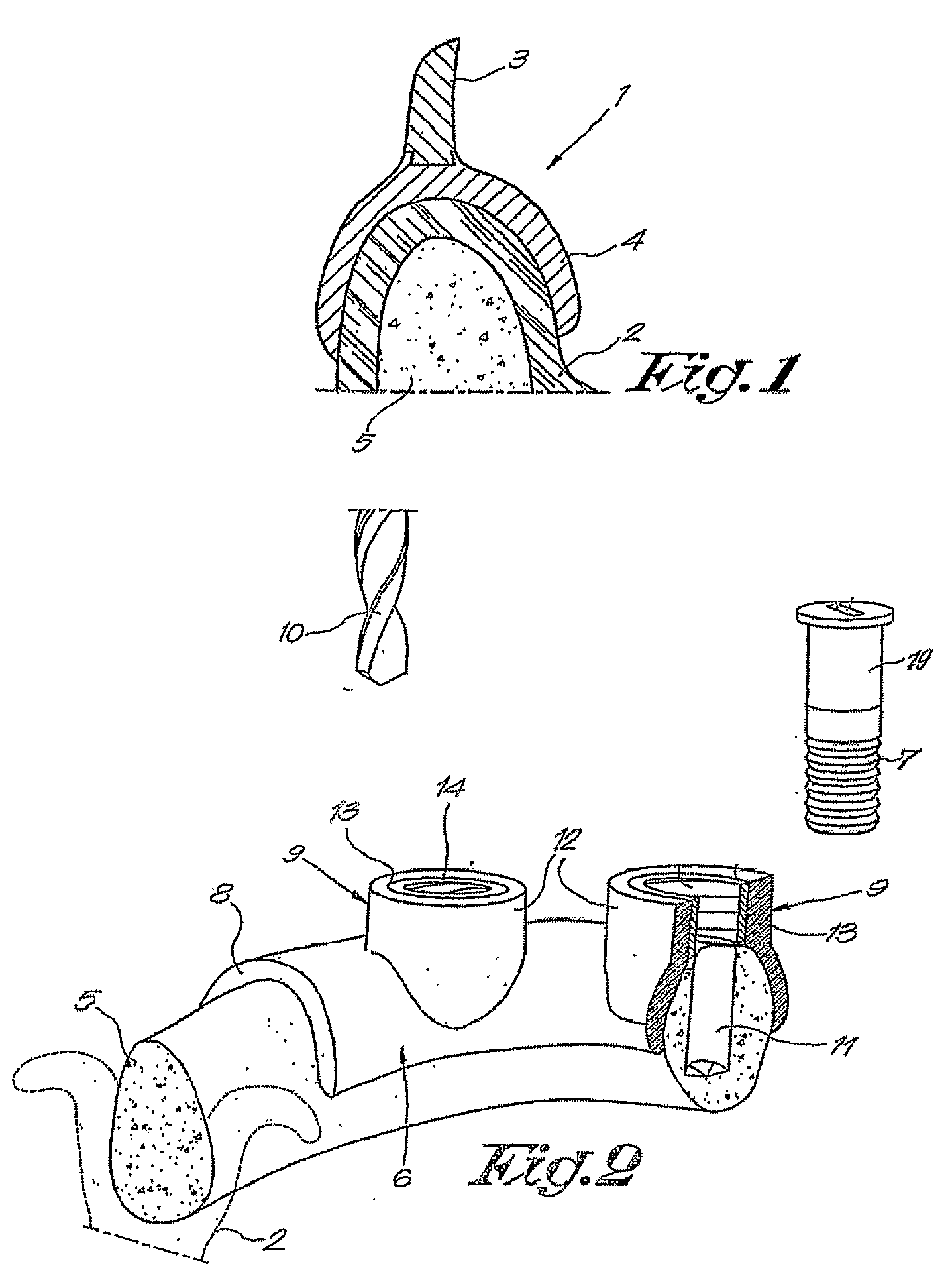 Dental Drilling Assembly