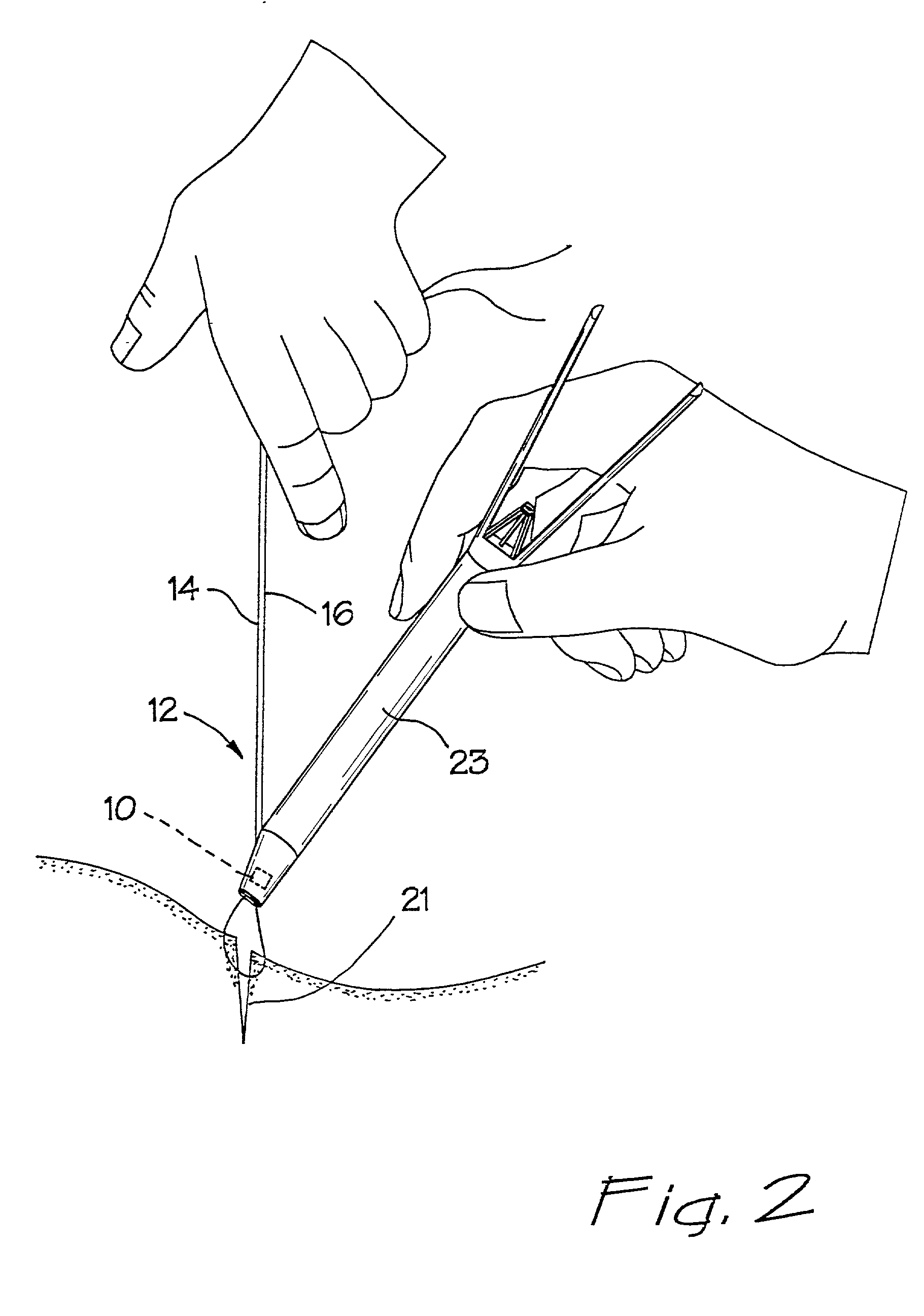 Surgical clip