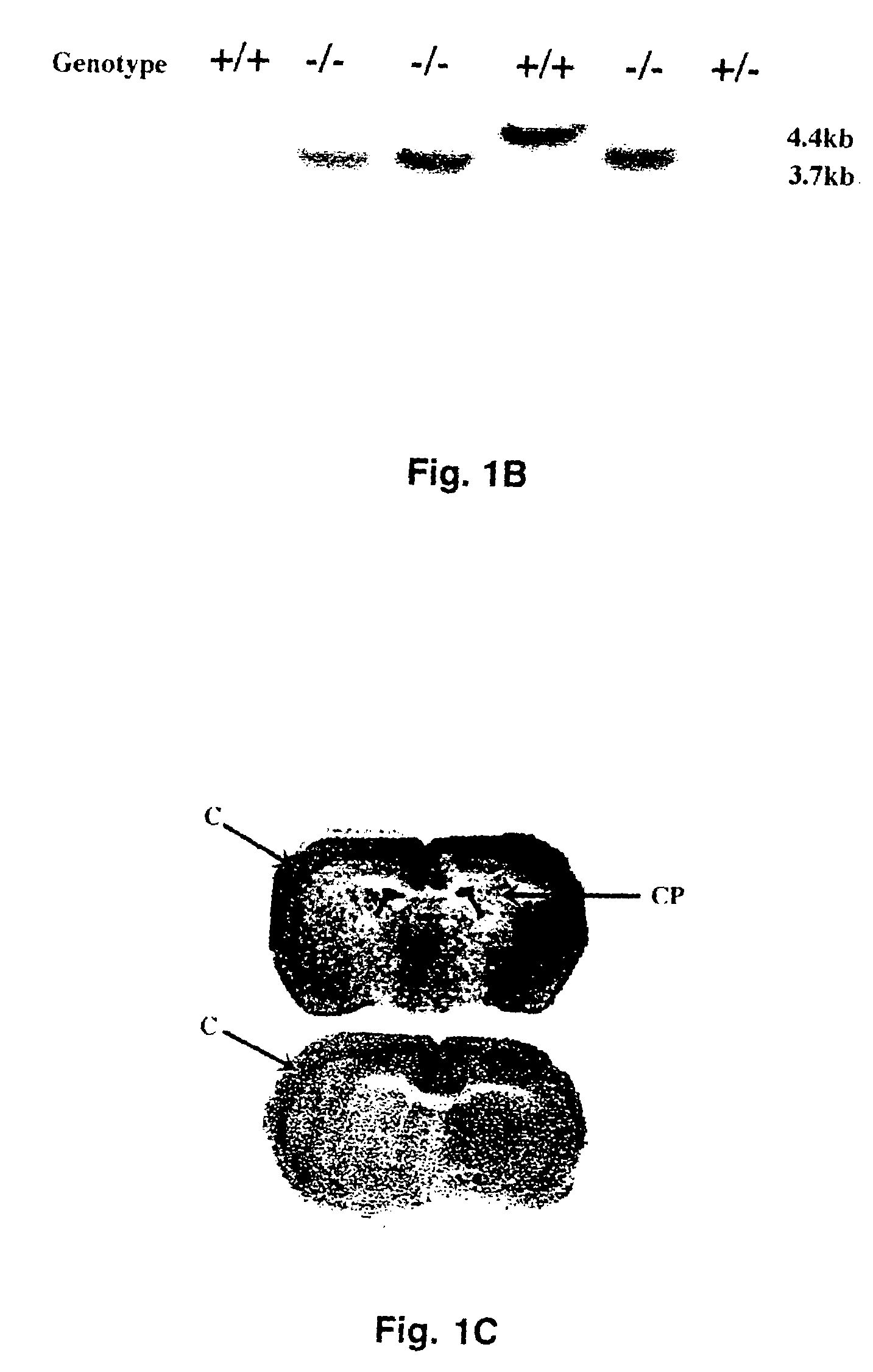 Method of inhibiting angiogenesis by administration of a corticotropin releasing factor receptor 2 agonist