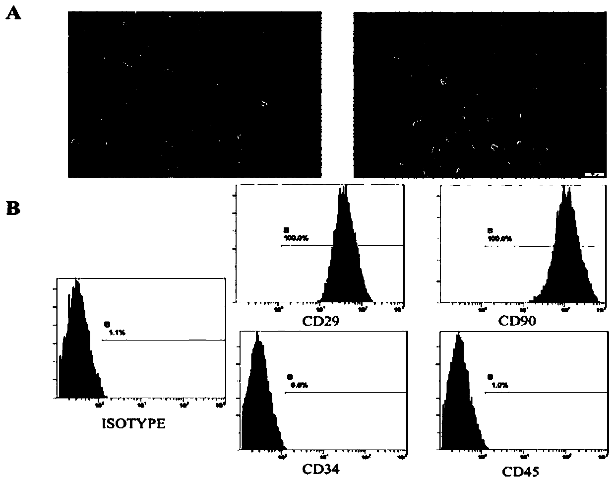 Cell model for screening developmental toxicity exogenous compounds by taking 11beta-HSD2 as target, as well as construction method and application of cell model