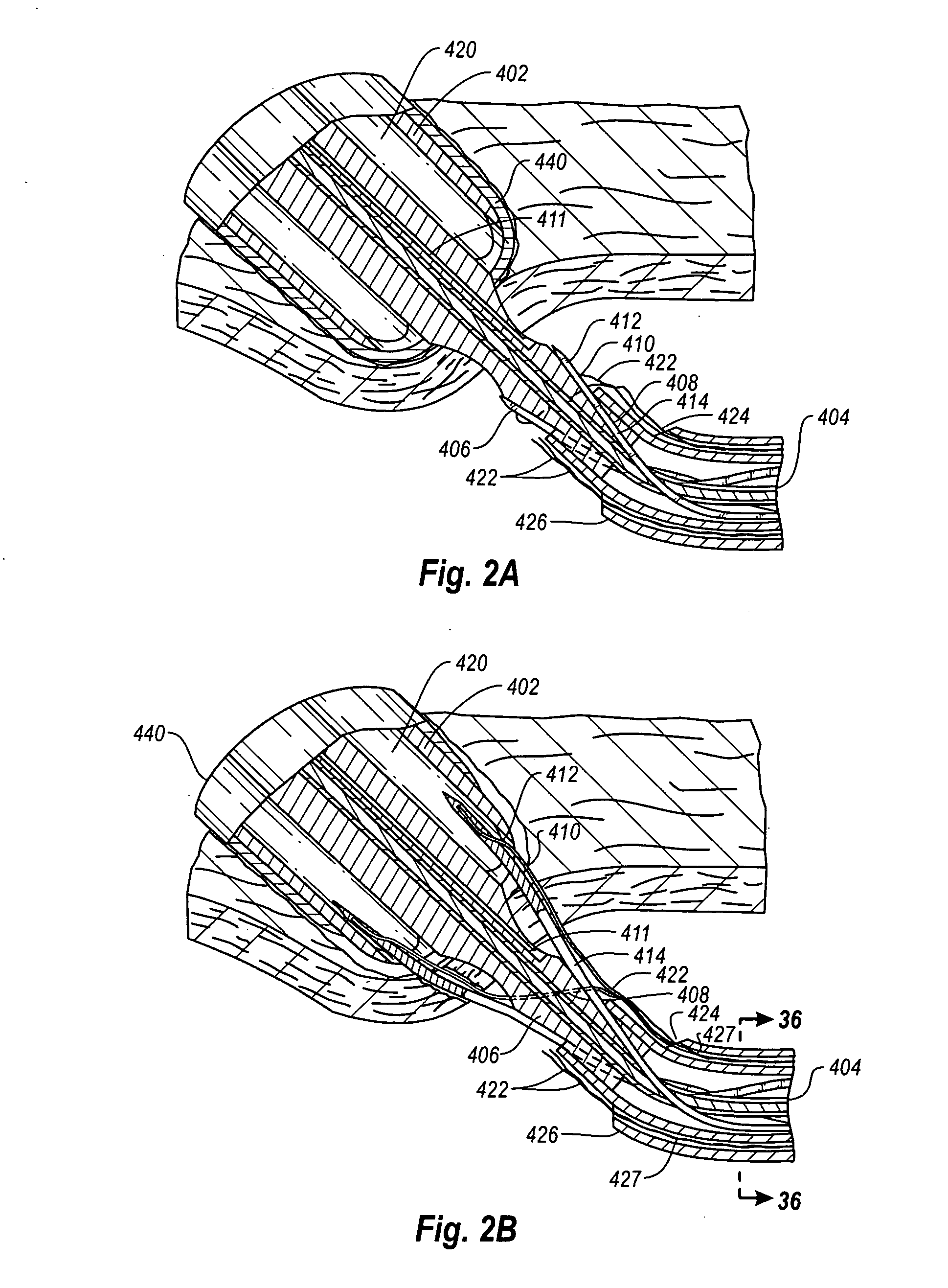 Device and Methods for Suturing Tissue