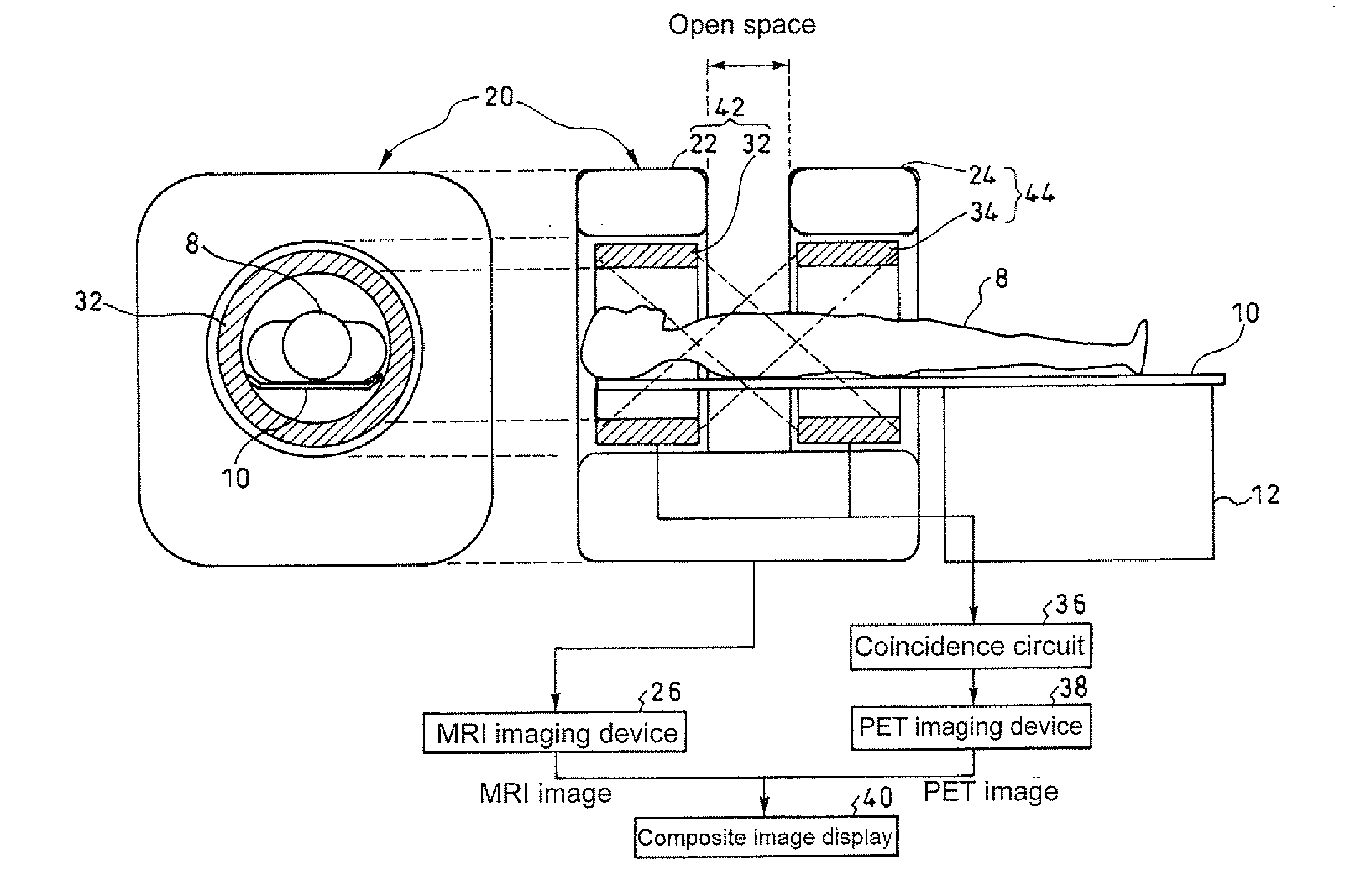 Open pet/mri hybrid machine