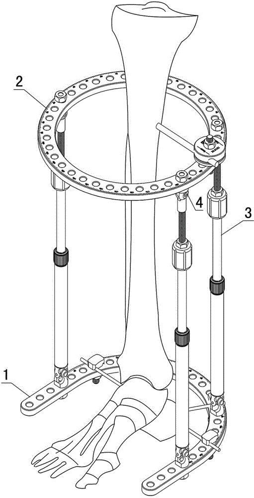 Ankle multidimensional regulation-control orthosis