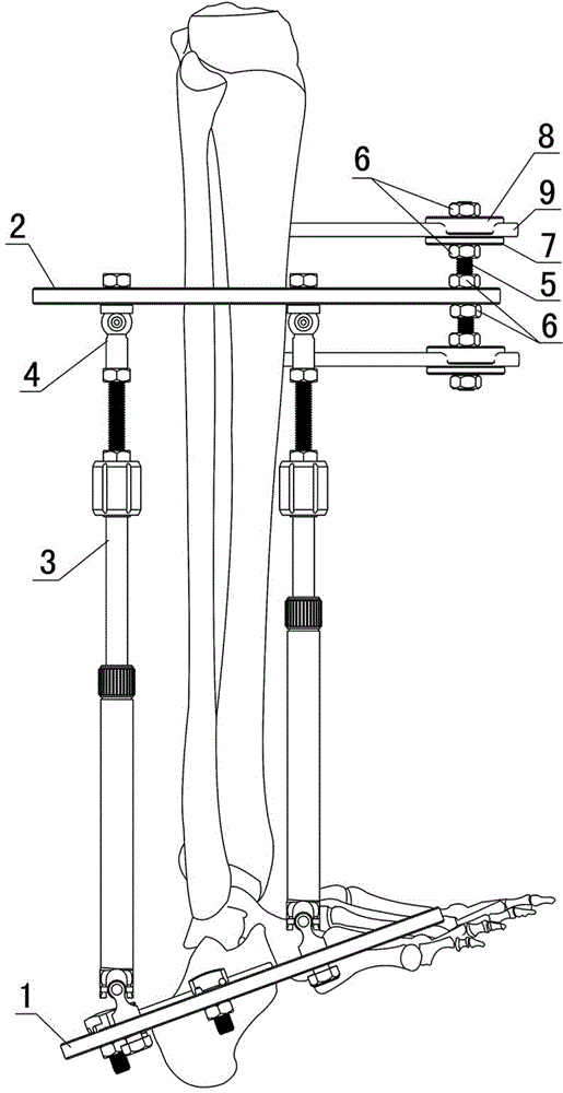 Ankle multidimensional regulation-control orthosis