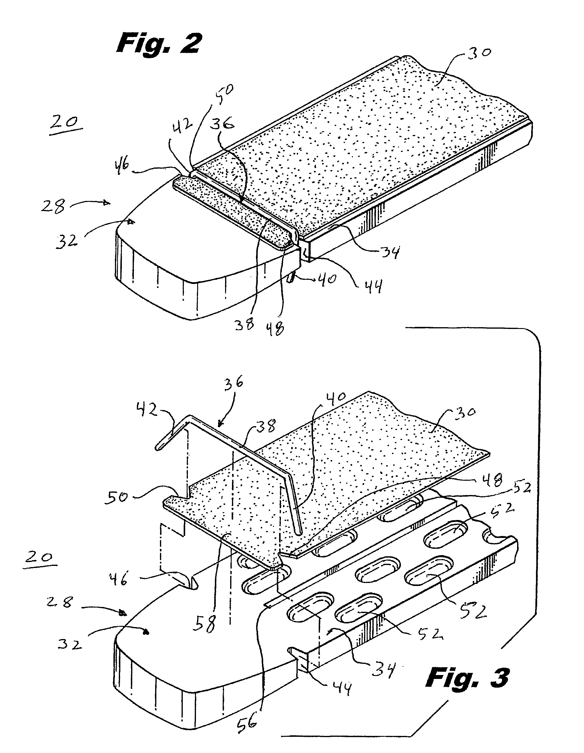 Crimp and release of suture holding buttress material