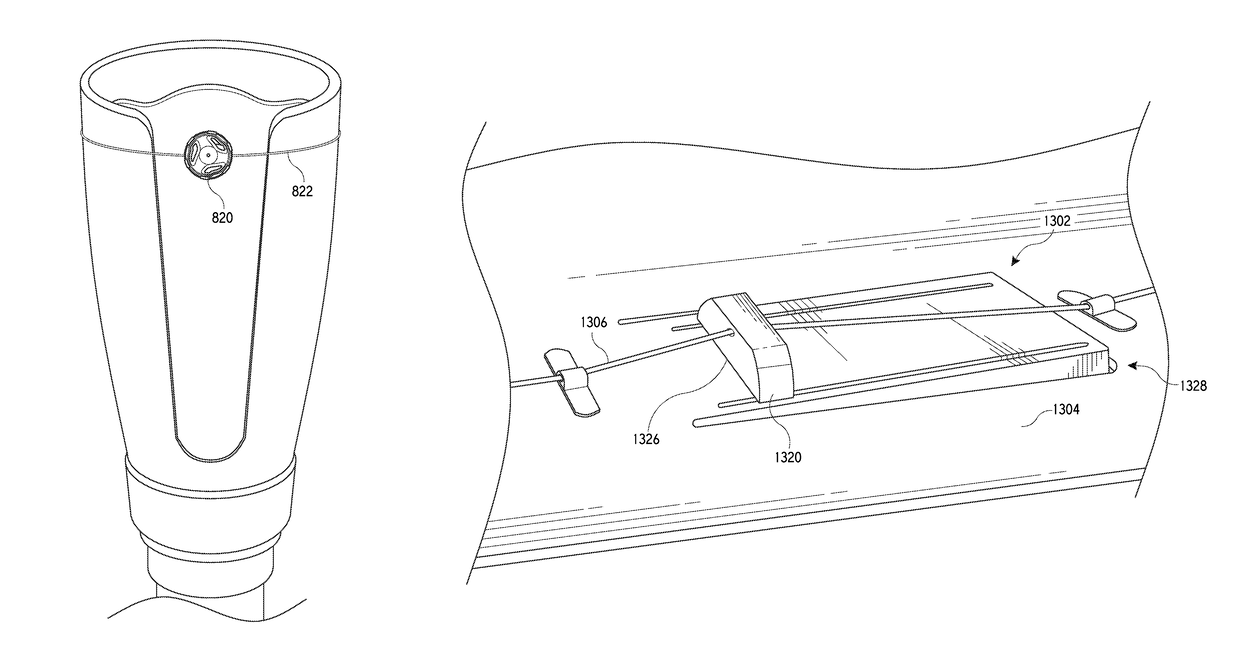 Methods and devices for providing automatic closure of prosthetics and orthotics