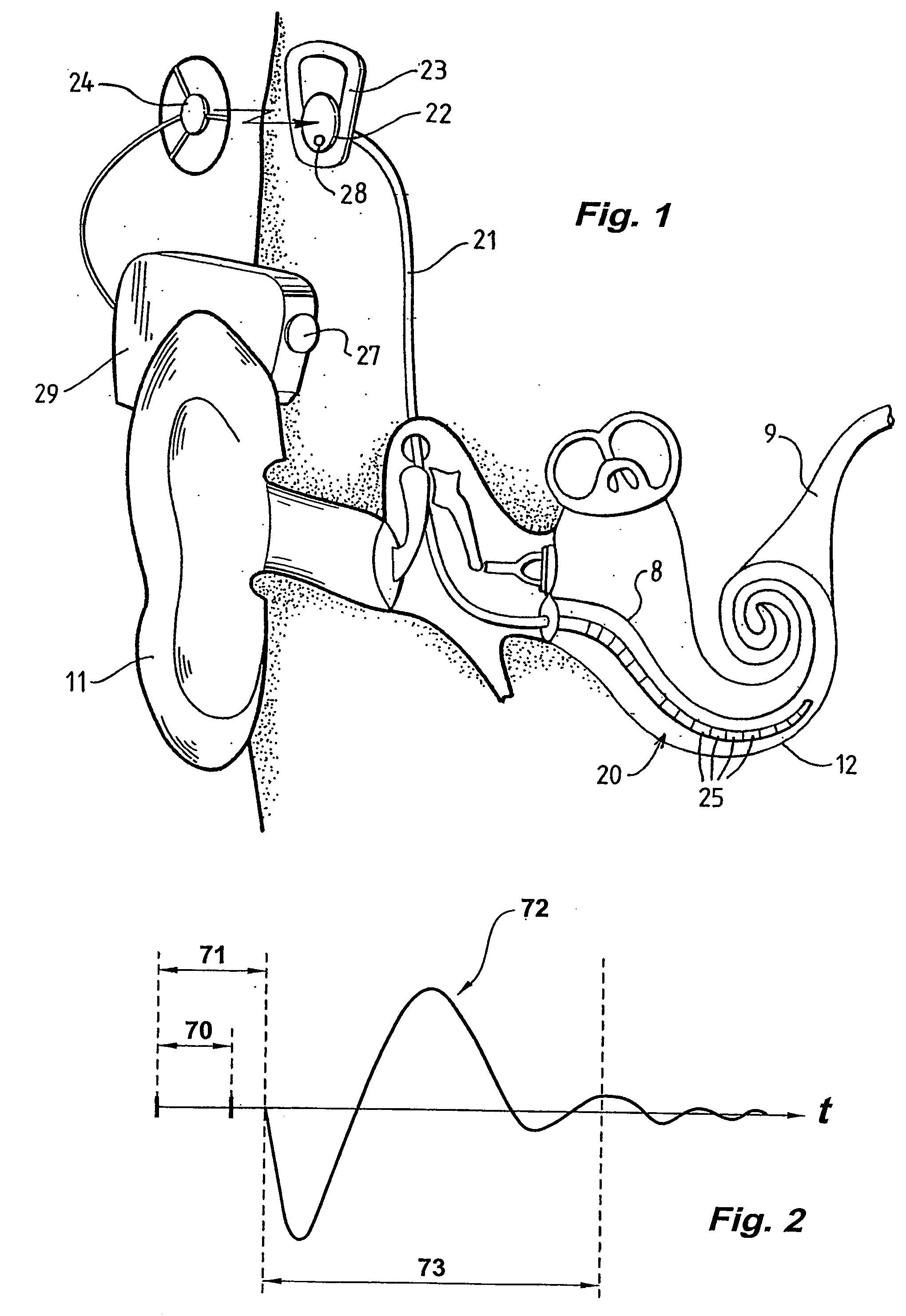 Method and apparatus for measurement of evoked neural response