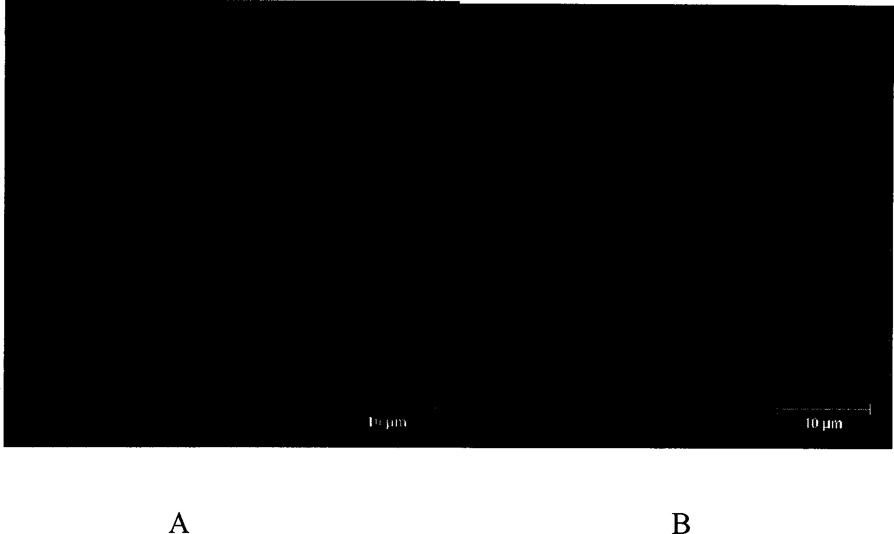 Maiignant malarial parasite msra-1 gene, protein product and use thereof