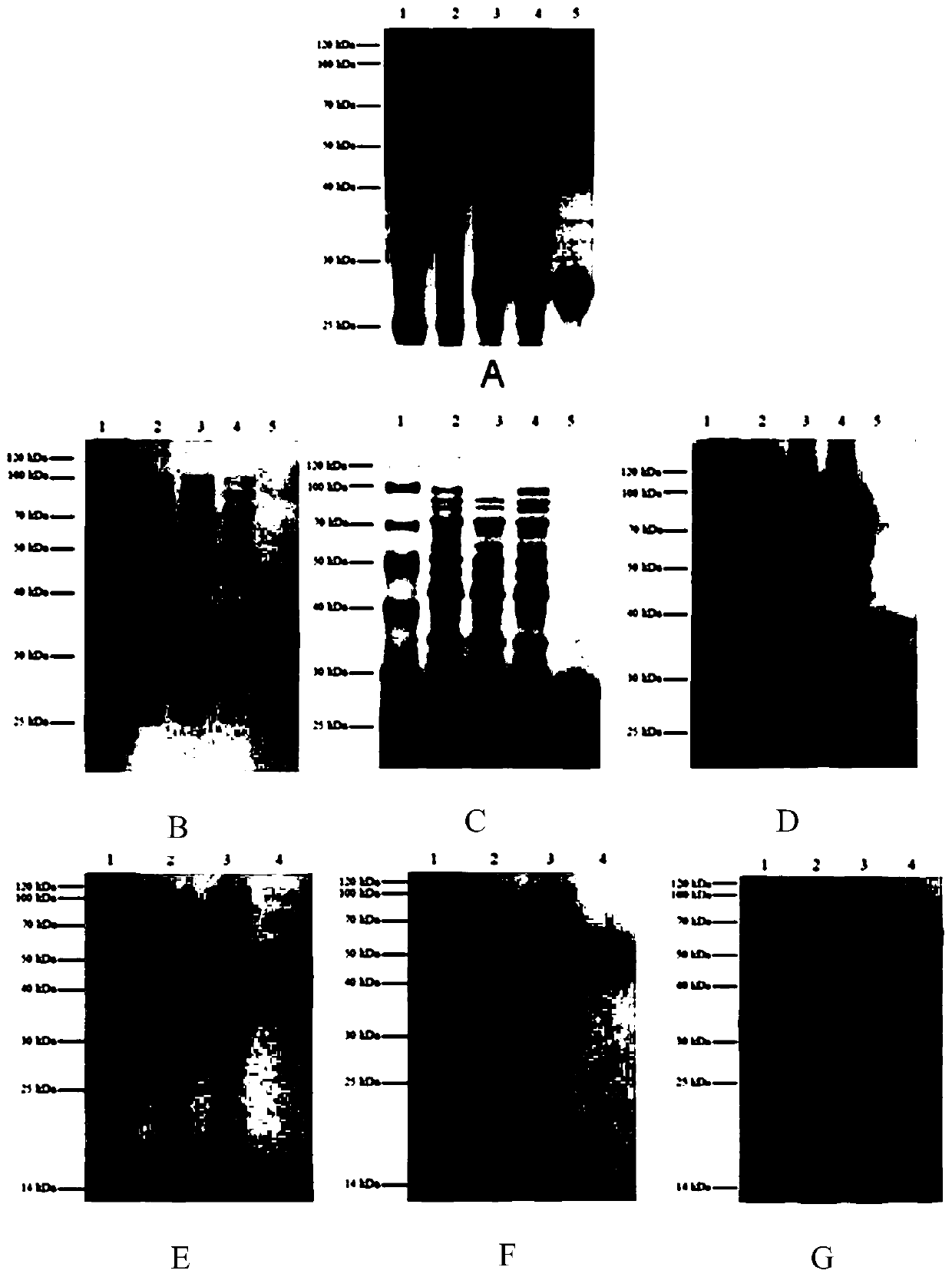 Preparation method for L-type rare ketohexose