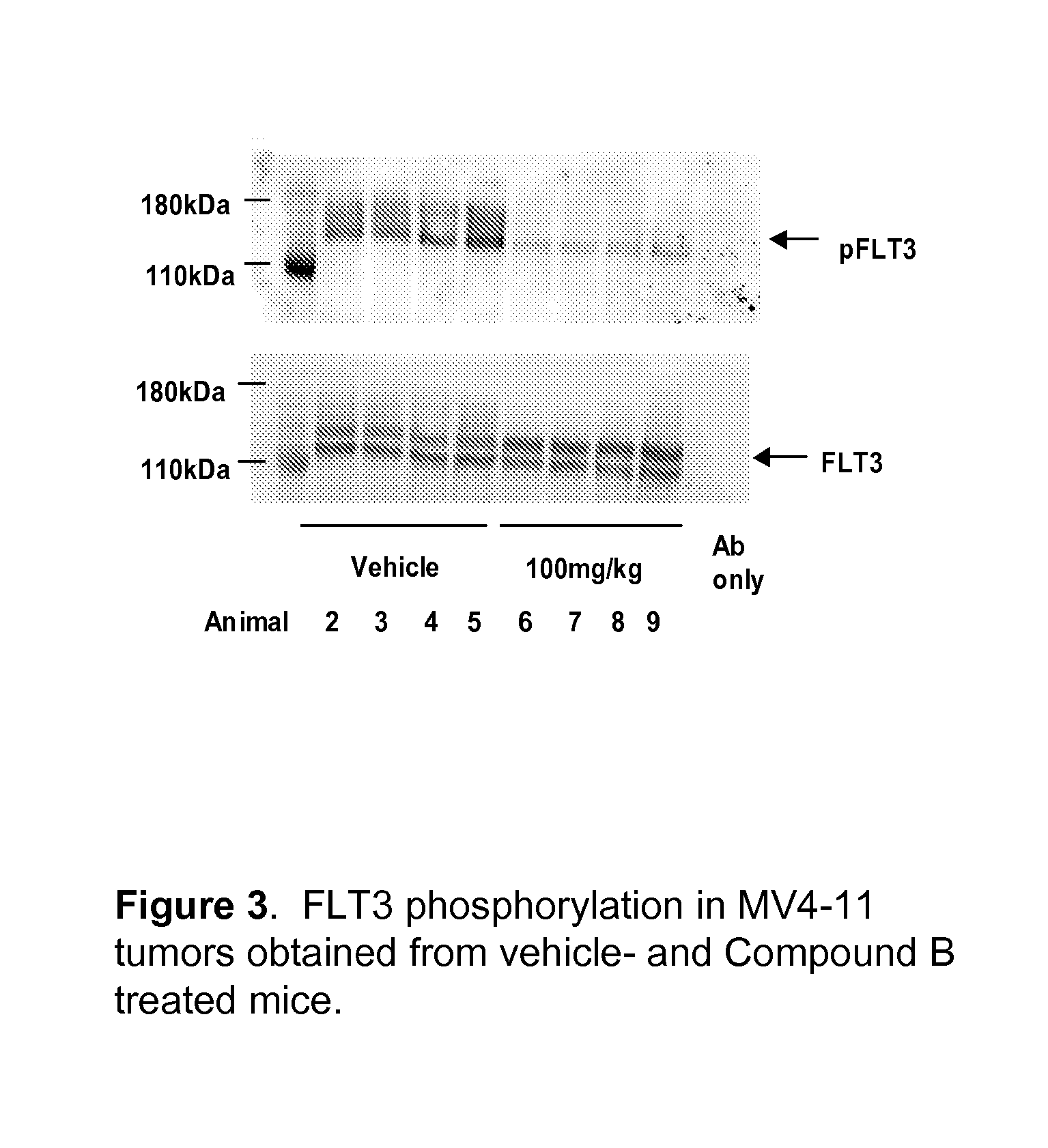 Synergistic modulation of flt3 kinase using aminoquinoline and aminoquinazoline kinase modulators