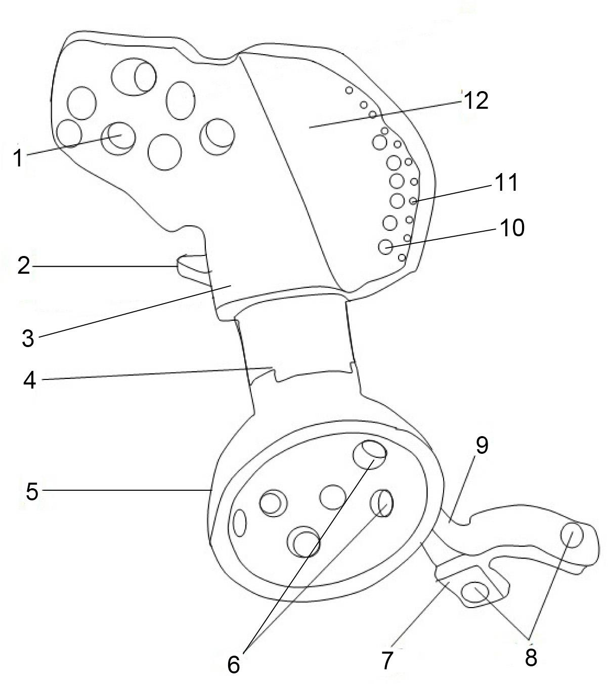 Semi-pelvic prosthesis