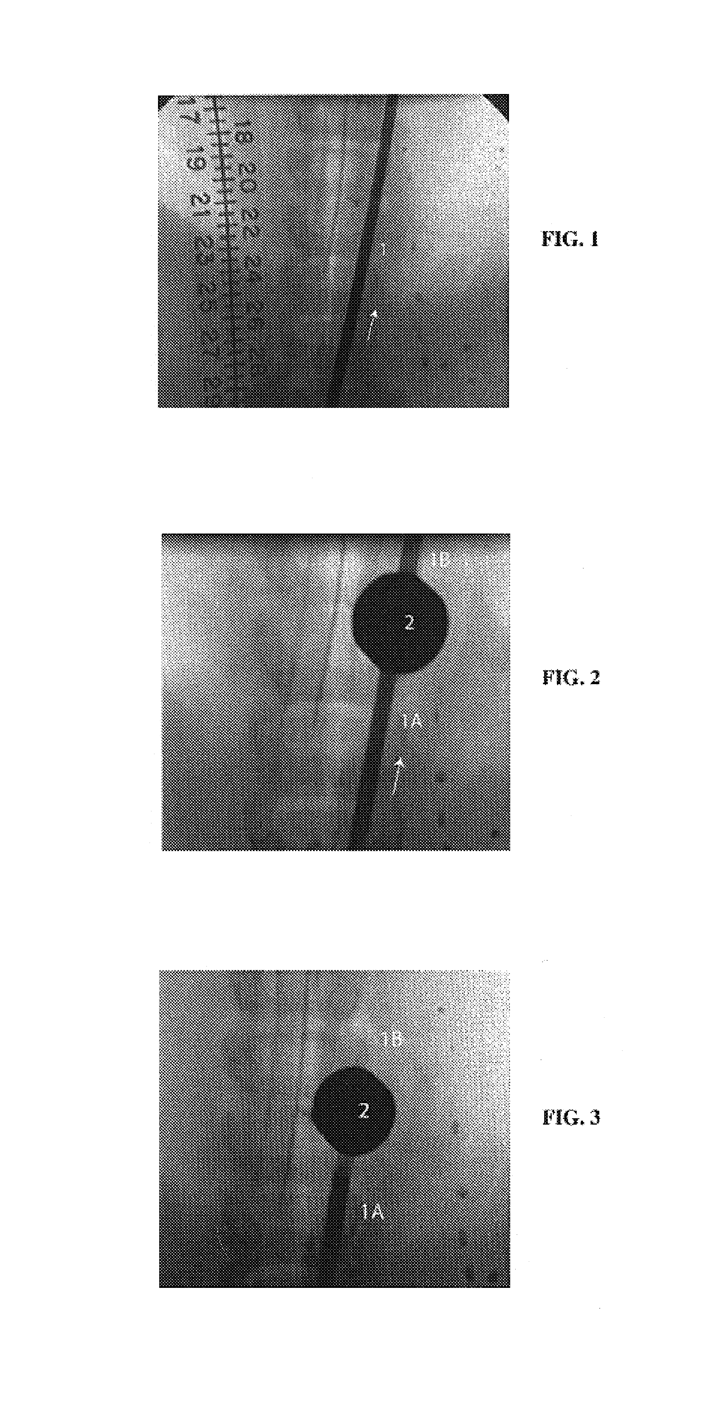 Medical devices for occlusion of blood flow