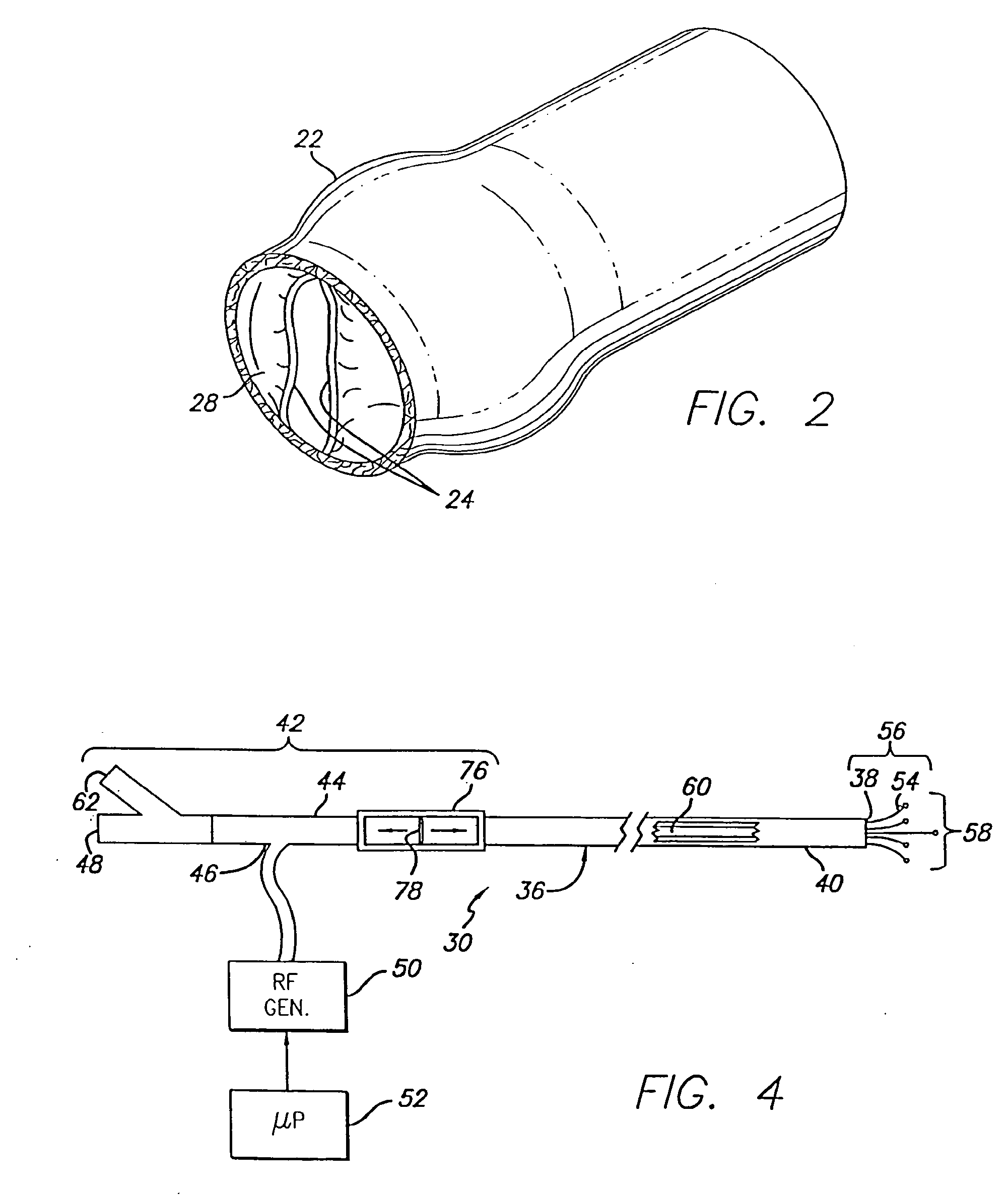 Method and apparatus for applying energy to biological tissue including the use of tumescent tissue compression