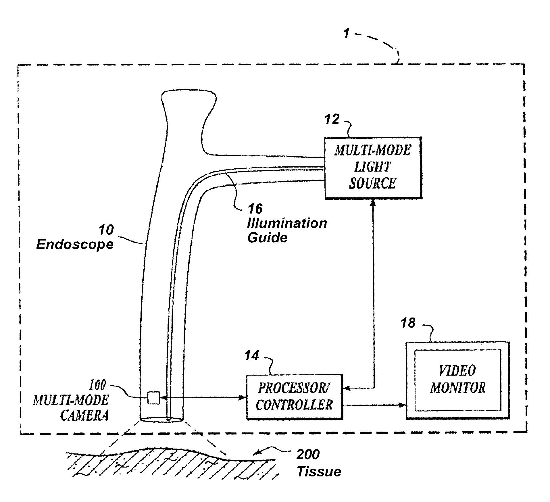 Imaging system with a single color image sensor for simultaneous fluorescence and color video endoscopy