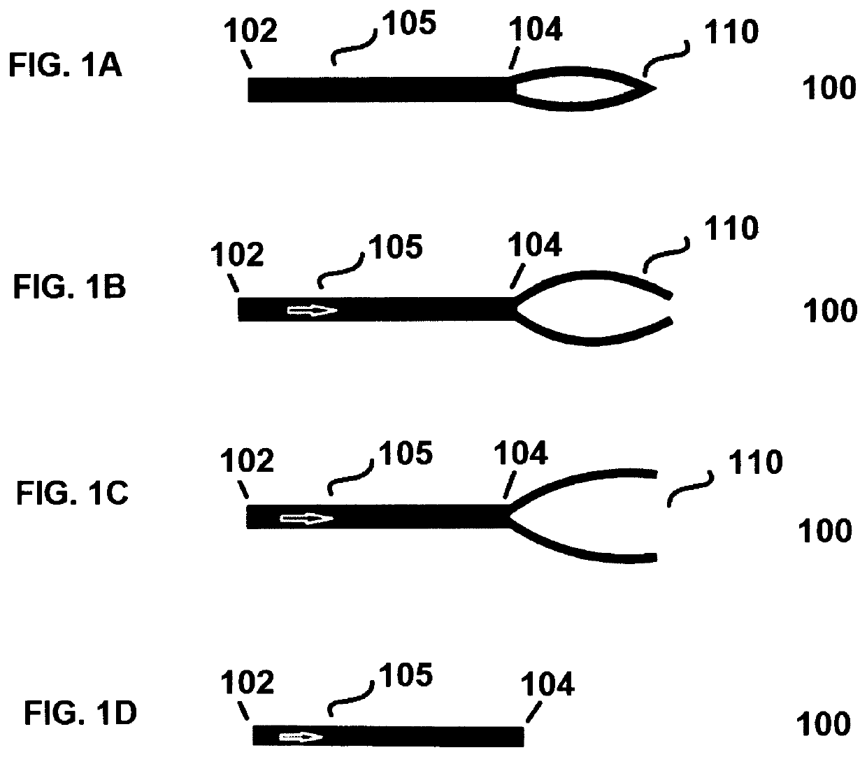 Glaucoma valve, a casing for containing a glaucoma valve, and a glaucoma drainage device comprising the valve and/or the casing