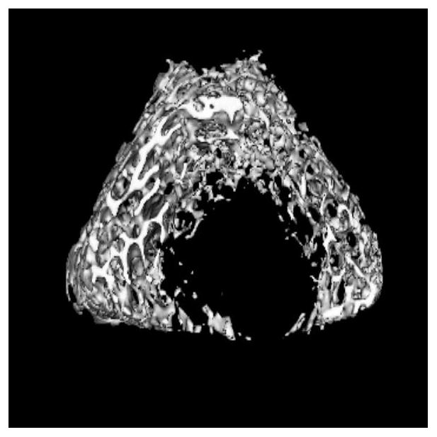 A traditional Chinese medicine composition preparation for preventing and treating postmenopausal osteoporosis and its preparation and application