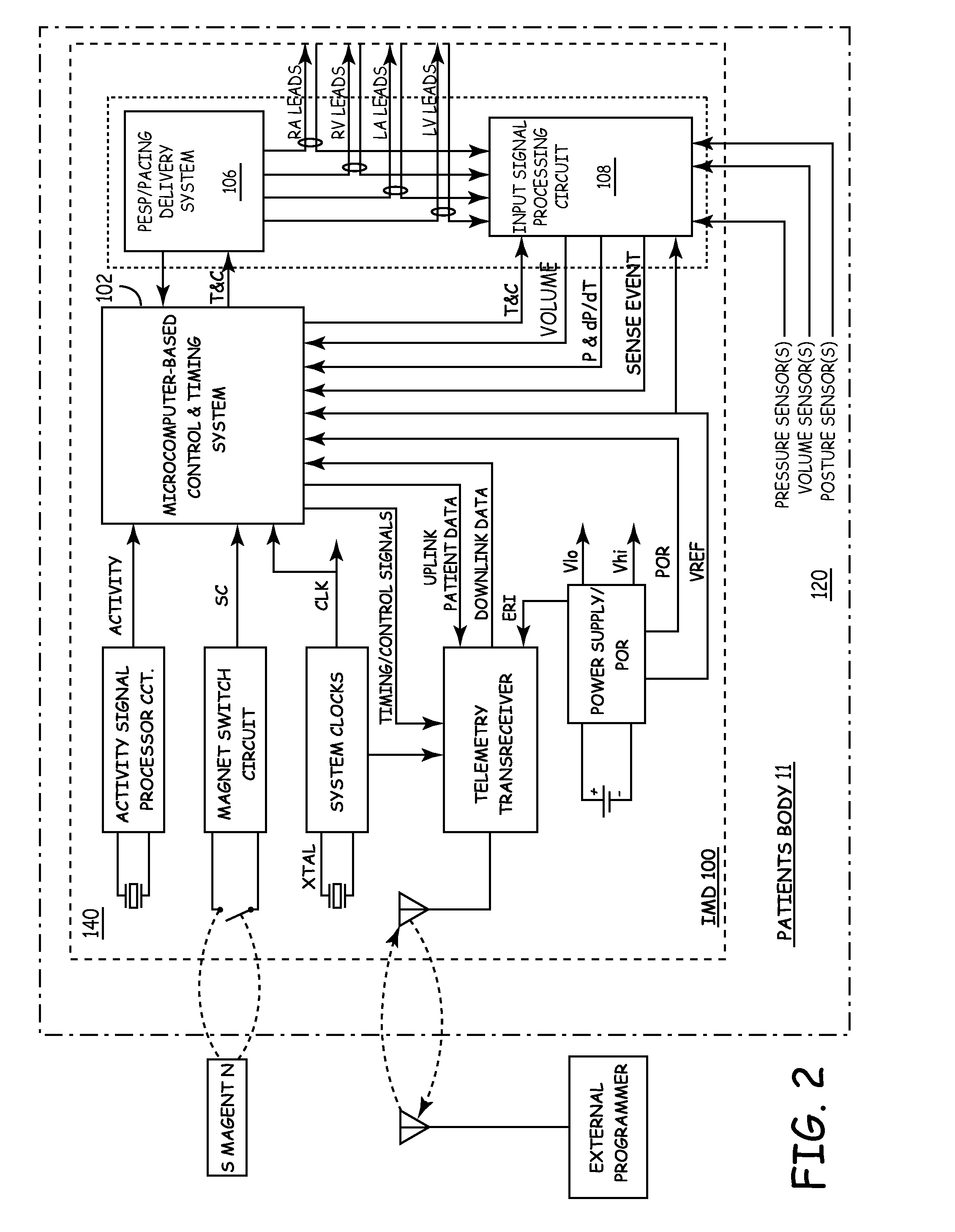 Method and apparatus for treating diastolic heart failure