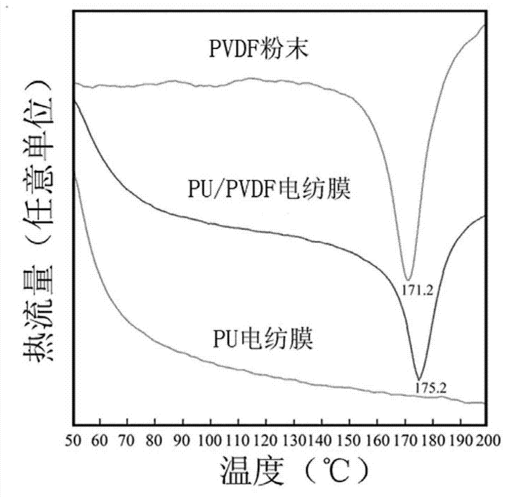 Functional wound dressing capable of accelerating wound healing and preparation method thereof