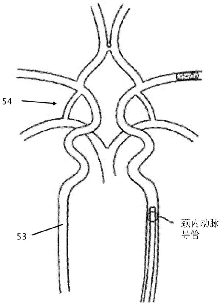 Insulative knudsen-effect catheter with reduced eccentricity