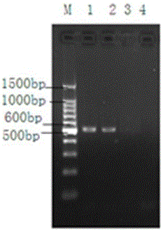 Ribosomal DNA ITS1 gene-based polymerase chain reaction (PCR) amplification kit for detecting clonorchis sinensis metacercaria and amplification primer