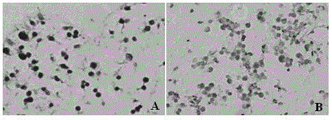 Kit for pancreatic decellularized scaffold, preparation of scaffold and replanting method