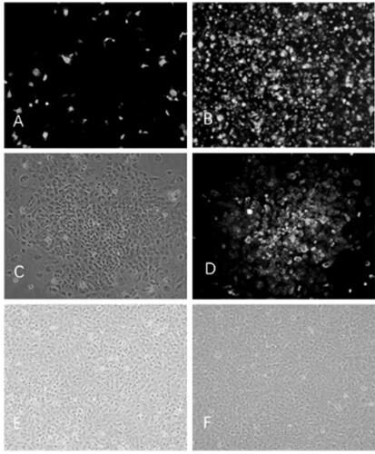 A kind of immortalized tree shrew intestinal epithelial cell line and its construction method and application