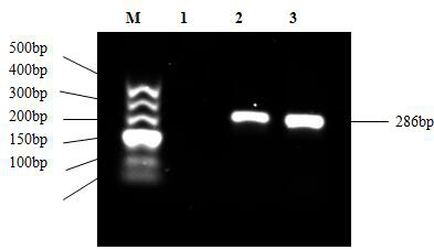 A kind of immortalized tree shrew intestinal epithelial cell line and its construction method and application