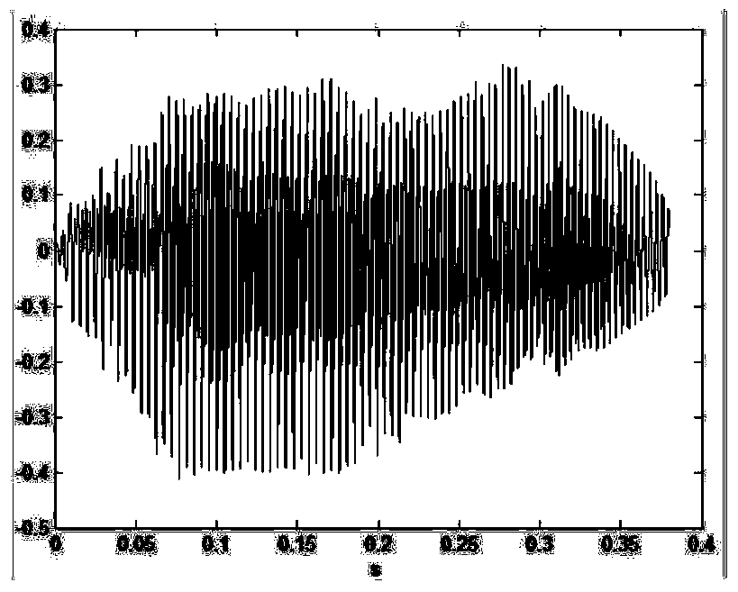 A method and system for automatic segmentation of consonants and finals in cleft palate speech