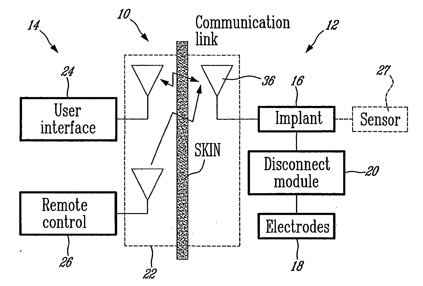 Implantable neurostimulator