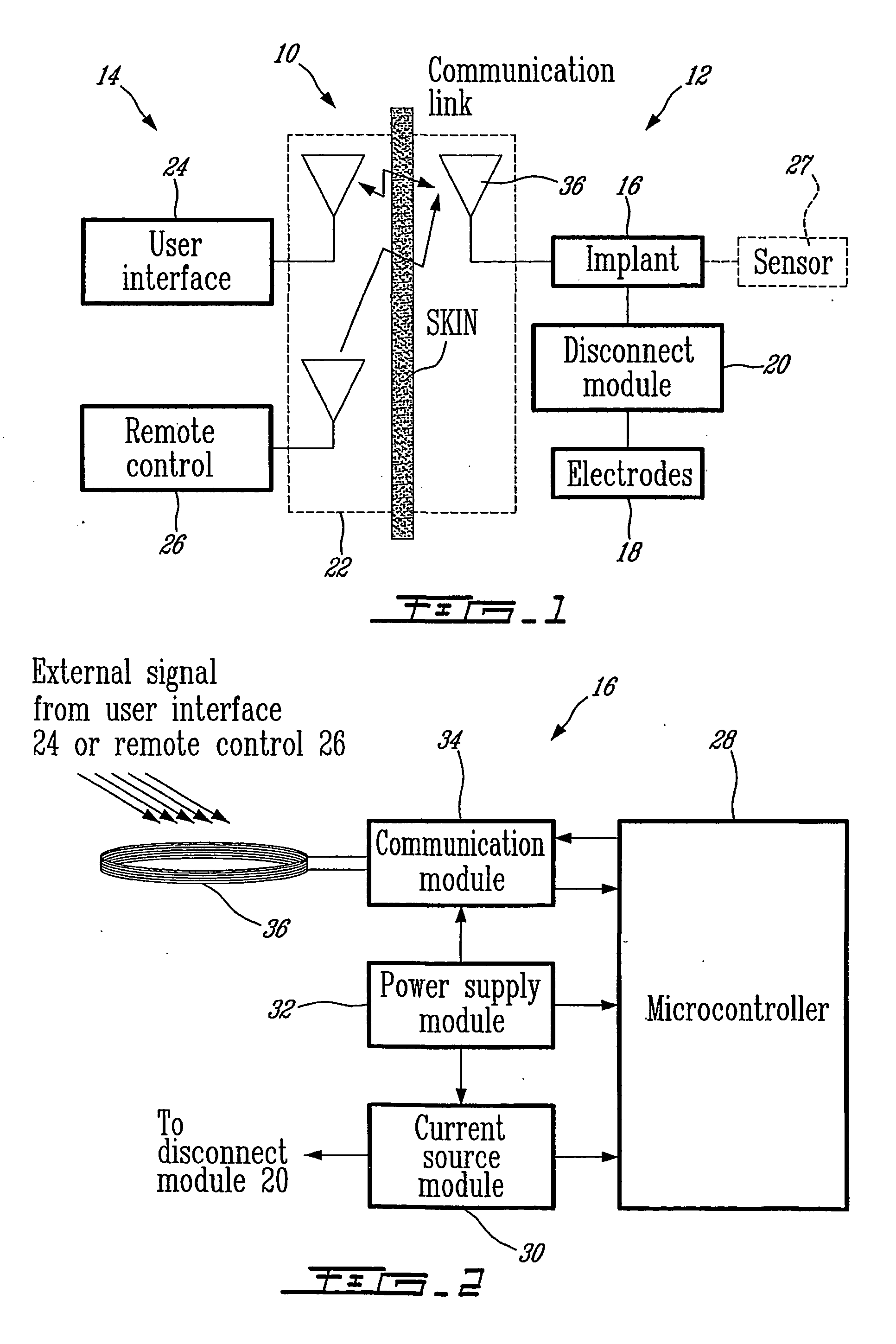 Implantable neurostimulator